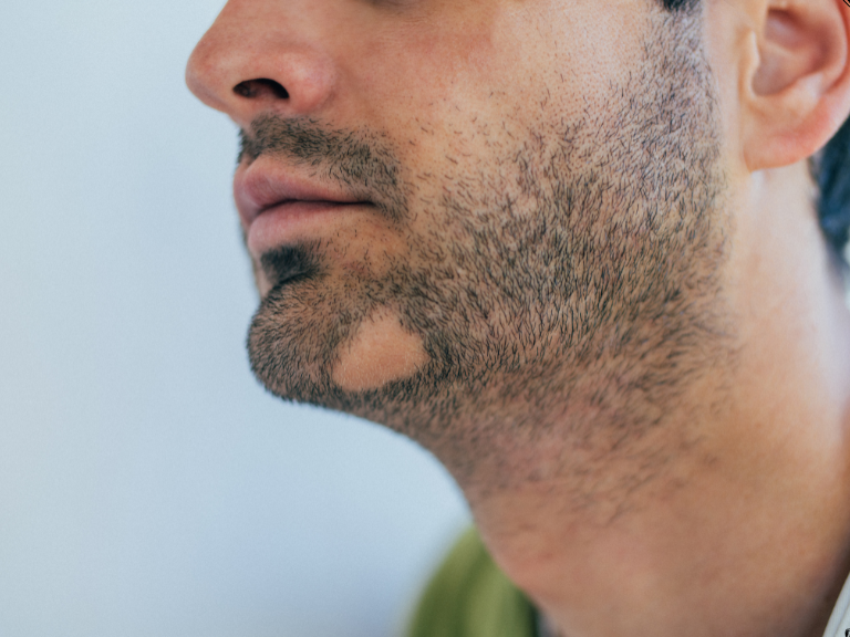 hairline definition (10)