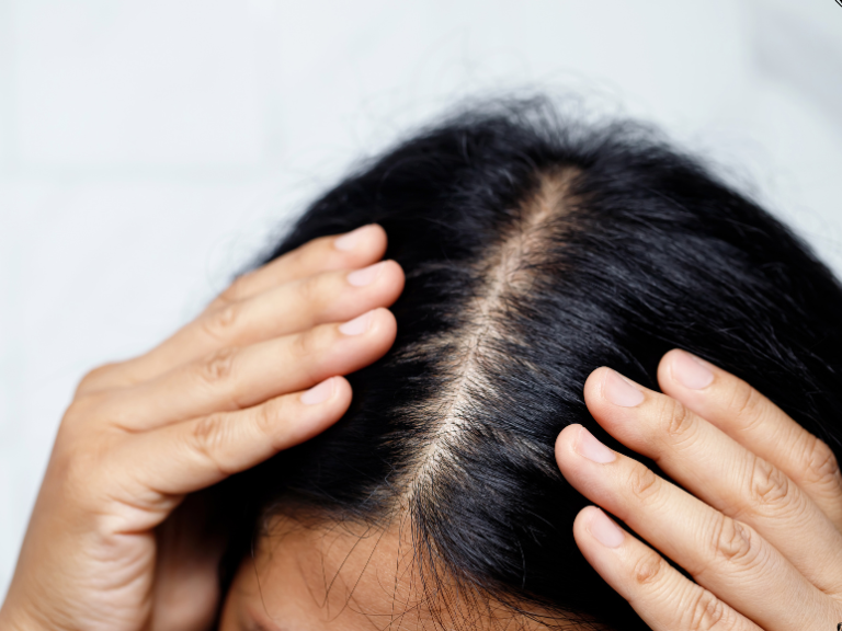 hairline definition (12)