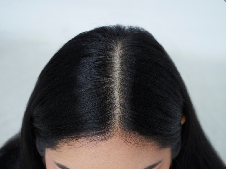 hairline definition (15)
