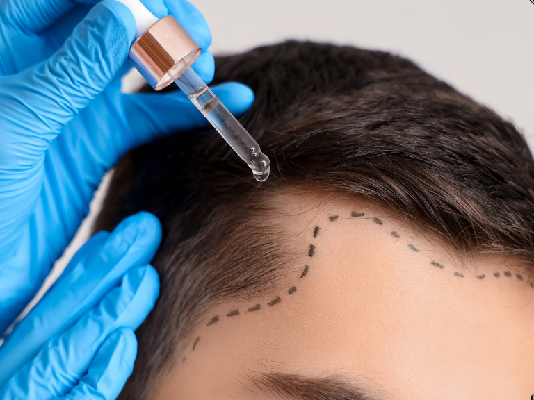hairline definition (16)