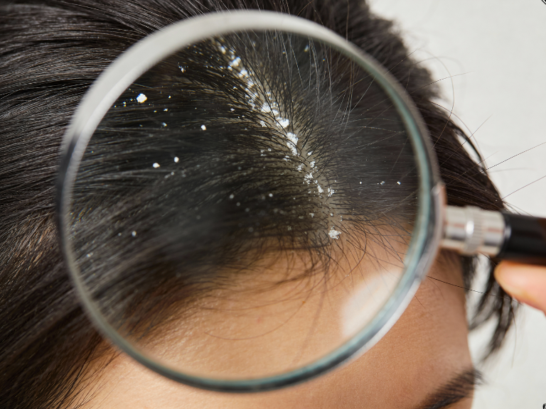 hairline definition (19)