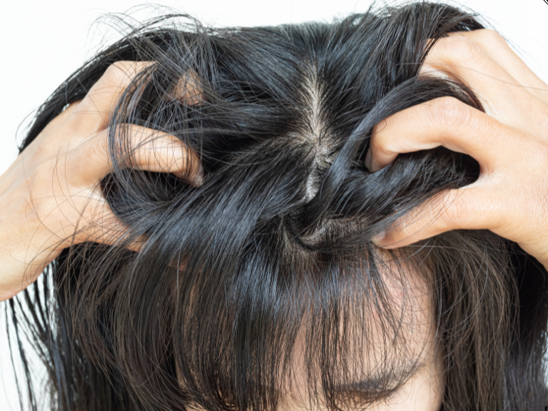 hairline definition (20)