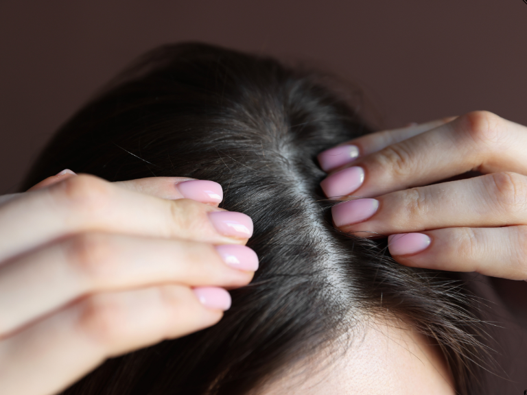 hairline definition (40)
